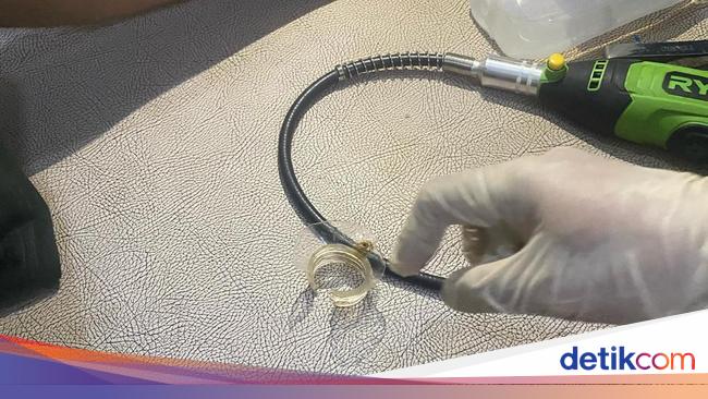 ABG Ini Ngeluh Tak Bisa Pipis Sampai RS Angkat Tangan, Damkar Turun Tangan